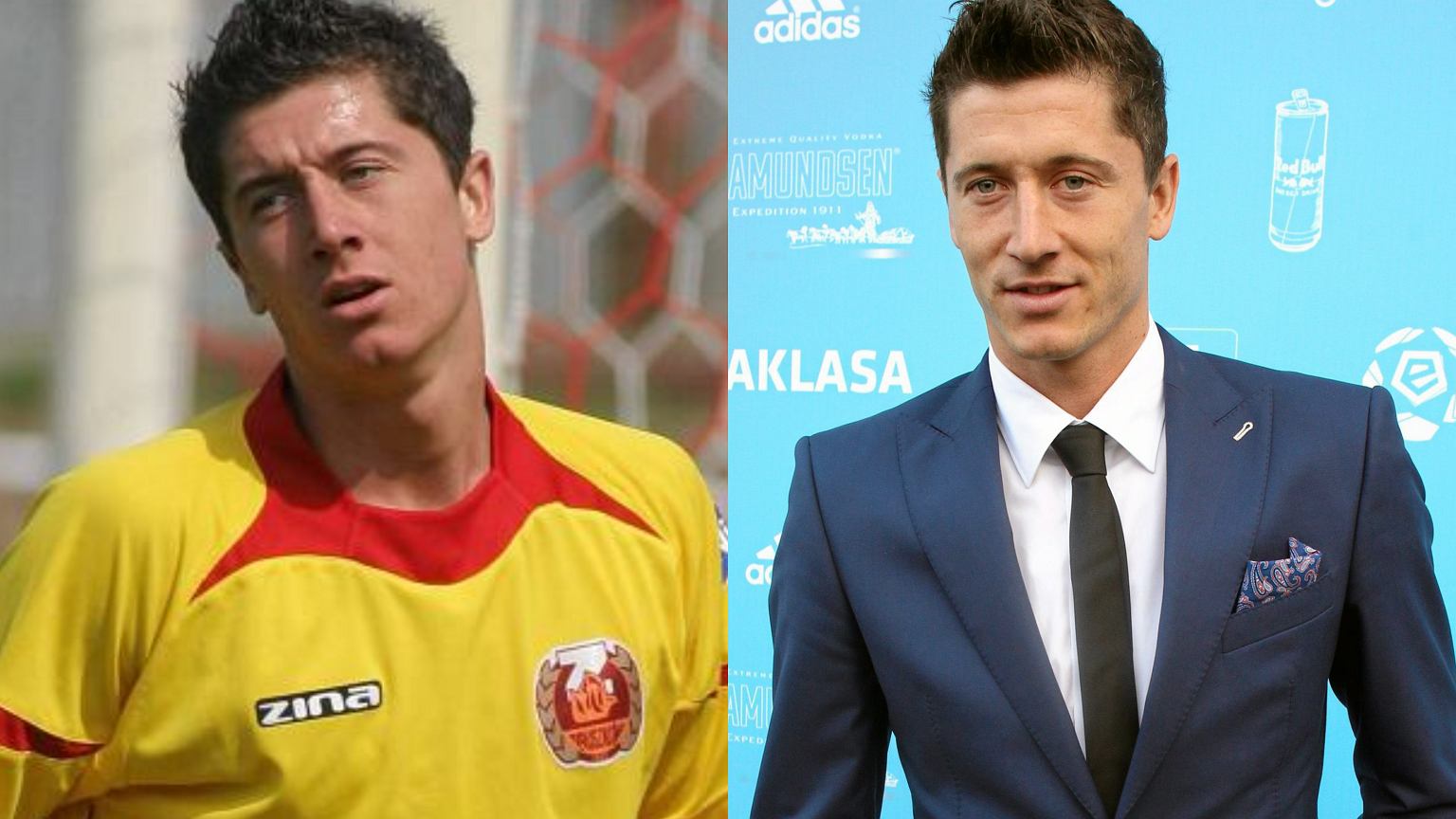 Lewandowski poddał się zabiegom upiększającym? Eksperci nie mają złudzeń - z31034402ierrobert-lewandowski-poddal-sie-zabiegom-upiekszajac.jpg