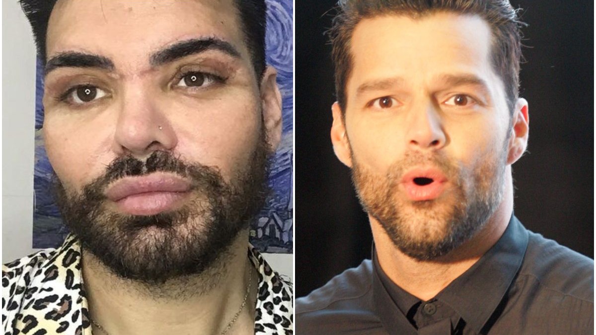 Chciał wyglądać jak Ricky Martin. Teraz ma ogromne problemy - awbncsw8ipqdq85yfqc3g1h3y4bj1gbi.jpg